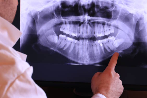 Best Urgent Care for Lost Fillings or Crowns in Green Valley, AZ