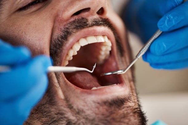 Best Emergency Treatment for Dental Infections or Abscesses in Green Valley, AZ